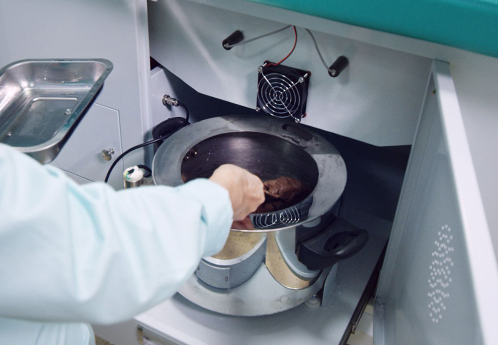 康復(fù)治療70天，偏癱患者步行出院！(圖2)