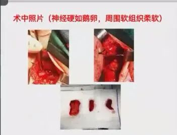 聚焦顯微外科|葫蘆島市醫(yī)學會顯微外科學分會第一屆第二次學術(shù)會議順利召開(圖5) 聚焦顯微外科|葫蘆島市醫(yī)學會顯微外科學分會第一屆第二次學術(shù)會議順利召開(圖5)